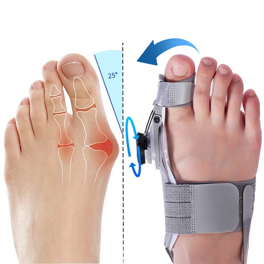 Treatmed Bunion Fix